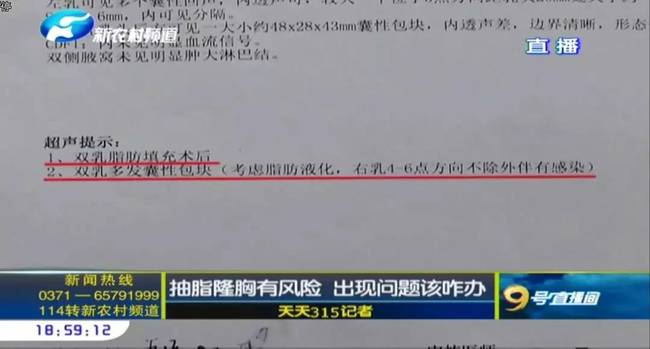 鄭州曹樂醫(yī)療整形：抽脂隆胸不靠譜 整出問題溝通難