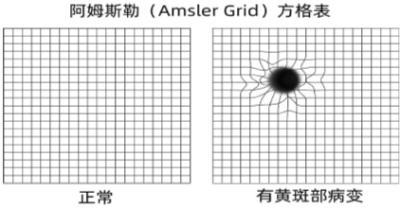 102歲老人突然眼盲后重獲光明 看清人臉時(shí)連稱活著有勁了