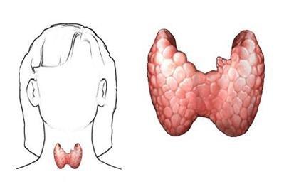 導致甲狀腺結節(jié)出現(xiàn)的因素有哪些