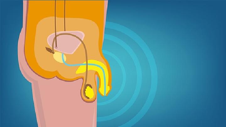 男性健康飲食方法有哪些 男性健康飲食離不開九要素