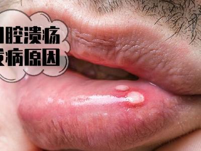 飲食減肥 談碳水化合物色變？6個(gè)理由告訴你不用怕