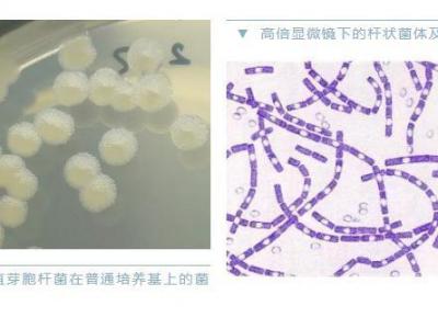 警惕炭疽，和新冠同一等級傳染??！